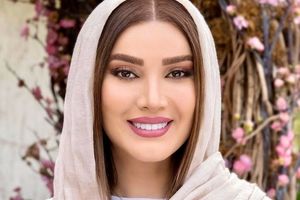 لیست تمام عمل های زیبایی متین ستوده | تغییر چهره باورنکردنی تازه عروس سینمای ایران + تصاویر